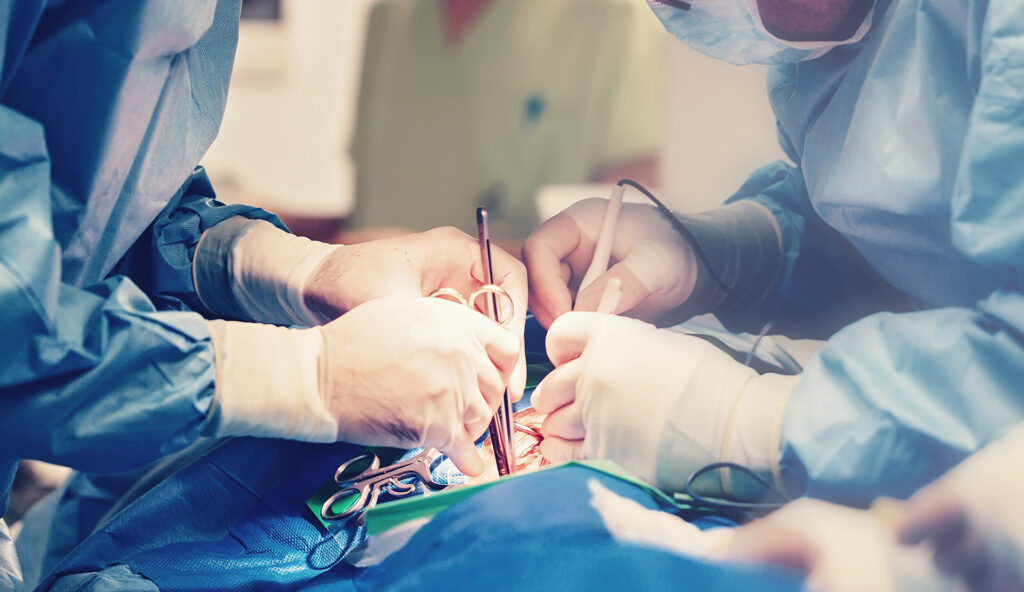 How Shared Mental Models Can Save Lives - surgeons performing cardiac surgery